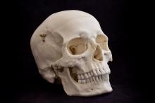 osteo- Cast Male European Skull w/ Calvarium Cut BC-212