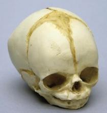 Osteo Cast Fetal Skull - 32 weeks  BC-181