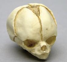 Osteo Cast Fetal Skull - 20 weeks BC-194