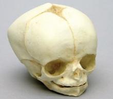 Osteo Cast Fetal Skull - 34 weeks old  BC-226