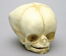 Osteo Cast Fetal Skull - 35 weeks old - BC-227
