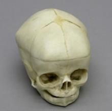 Osteo Cast Fetal Skull 40 weeks BC-281 W/ Calvarium Cut