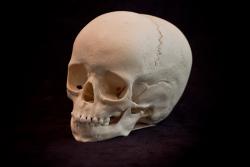 Osteo- Cast Child Skull, 5 Years of Age, BC-116