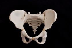 Osteo Cast Children's 5-Year Old Pelvis and Sacrum SC-183-P