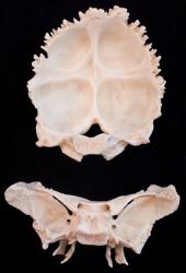 Somso Sphenoid and Occiput QS9-3-10 & -11