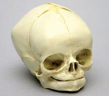Osteo Cast Fetal Skull - 40 weeks BC 182
