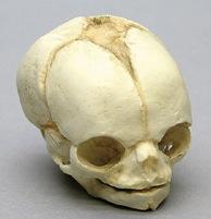 Osteo Cast Fetal Skull - 21 1/2 week old BC-220