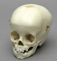 Osteo Cast Child Skull 1 yr. old w/ Calvarium Cut BC-280