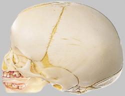 Full Term Fetal Skull - Somso QS 3
