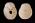 Osteo Cast Child Skull 1 yr. old w/ Calvarium Cut BC-280