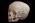 Osteo Cast Child Skull 1 yr. old w/ Calvarium Cut BC-280