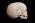 Osteo Cast Child Skull 1 yr. old w/ Calvarium Cut BC-280