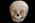 Osteo Cast Child Skull 1 yr. old w/ Calvarium Cut BC-280