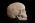 Osteo- Cast Child skull, 5 years of age, Calvarium Cut, BC-188