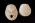   Osteo- Cast Child skull, 5 years of age, Calvarium Cut, BC-188